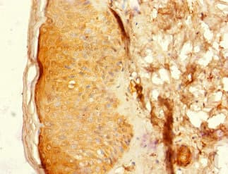 Polyclonal Rabbit anti-Human CNTN4 Antibody (IHC)