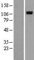 Human ROR1 Protein (Over-Expression Lysate Myc-DDK (Flag))