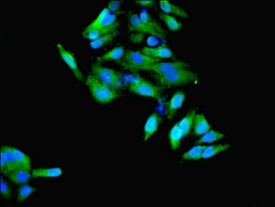 Polyclonal Rabbit anti-Human HSD11B1 / HSD11B Antibody (aa25-292, IHC, WB)
