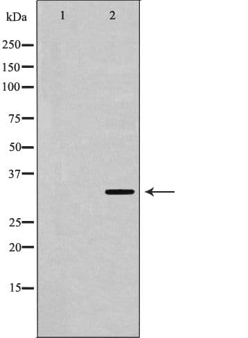 Polyclonal Rabbit anti-Human USF1 / USF Antibody (IHC, WB)