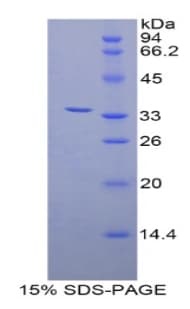 Human ZAP70 Protein (Recombinant His-T7)