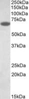 IHC-plus™ PDIA2 Antibody (aa477-489)