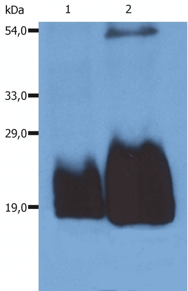 PathPlus™ CD59 Antibody (clone MEM-43/5)