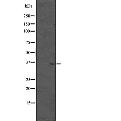 CPXCR1 / CT77 Antibody