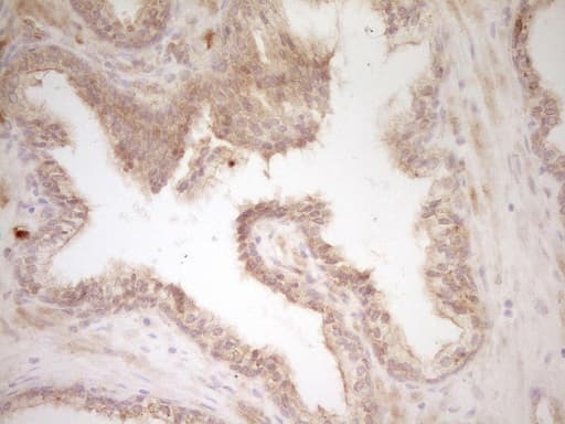 SLAMF7 / CRACC Antibody (clone OTI1F1)