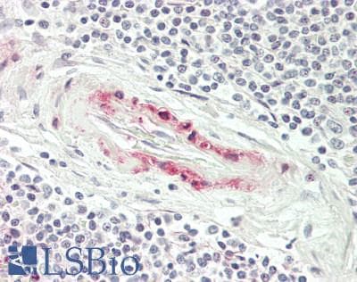 IHC-plus™ HMOX1 / HO-1 Antibody (clone 5C6)