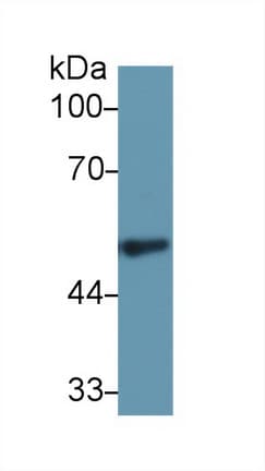 FGG / Fibrinogen Gamma Antibody (aa170-429)