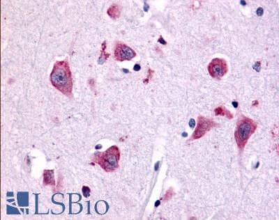 PathPlus™ TAOK1 / TAO1 Antibody (Internal)