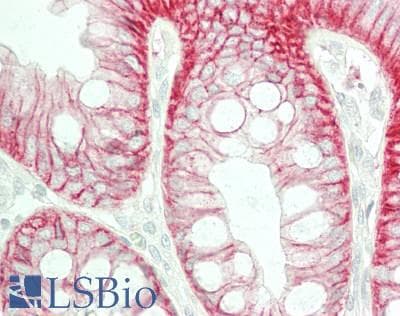 PathPlus™ Monoclonal Mouse anti-Human CTNNB1 / Beta Catenin Antibody (clone 14, IHC)
