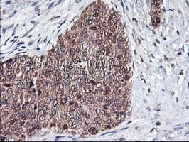 ALS2CR1 / NIF3L1 Antibody (clone OTI4B5)