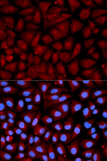 Polyclonal Rabbit anti-Human Antithrombin-III Antibody (IHC, IF, WB)