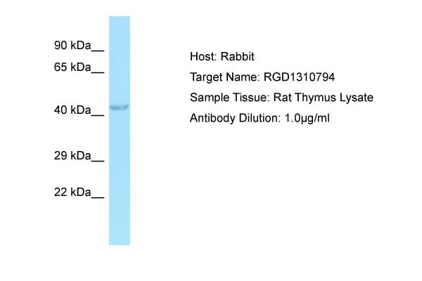 HSPC304 / C7orf64 Antibody (aa42-91)