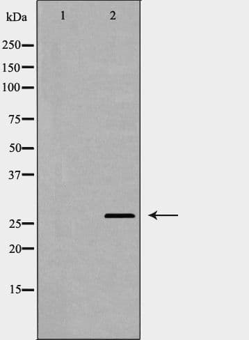 PRNP / PrP / Prion Antibody