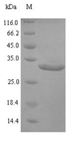 Orangutan TTR / Transthyretin Protein (Recombinant 6His-SUMO, N-terminus)