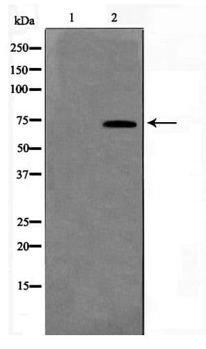 TK1 / TK / Thymidine Kinase Antibody