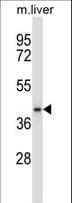 Polyclonal Rabbit anti-Human DPAGT2 / DPAGT1 Antibody (aa28-57, WB)