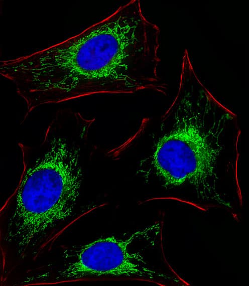 GLS / Glutaminase Antibody (aa516-545)