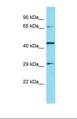 Polyclonal Rabbit anti-Human KLHL30 Antibody (C-Terminus, WB)