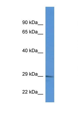 RAB2B Antibody (C-Terminus)