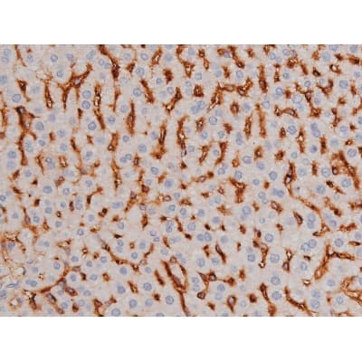 Polyclonal Rabbit anti-Human MAPT / Tau Antibody (phospho-Thr181, IHC, WB)