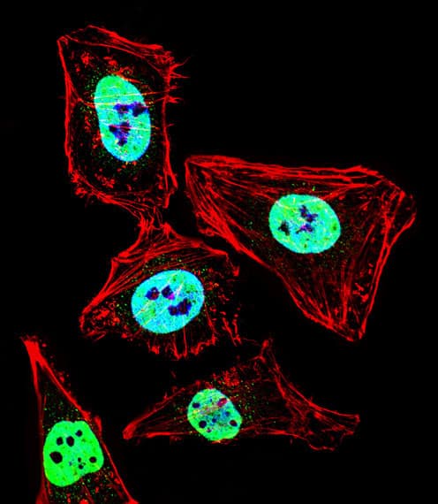 Polyclonal Rabbit anti-Human HDAC2 Antibody (aa410-439, IHC, IF, WB)