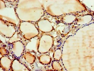 PAK2 Antibody (aa1-212)