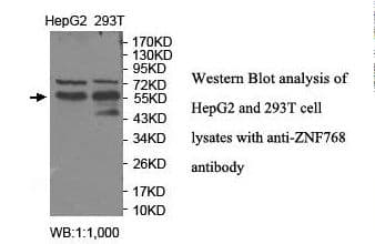 Polyclonal Rabbit anti-Human ZNF768 Antibody (aa20-243, IHC, WB)