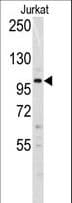 DNMT3A Antibody (aa31-61)