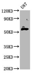 Polyclonal Rabbit anti-Human GPT2 / ALT2 Antibody (IHC, WB)
