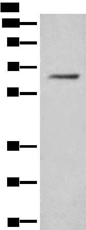Polyclonal Rabbit anti-Human Translokin / CEP57 Antibody (IHC, WB)