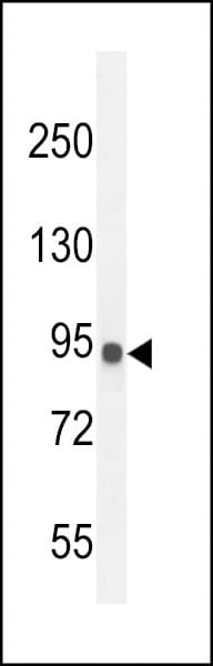 IHC-plus™ IL12RB2 Antibody (aa756-783)