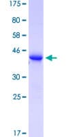Human T-cell receptor delta chain (tcrd) Protein (Recombinant GST)