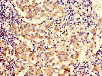Polyclonal Rabbit anti-Human MAP10 / KIAA1383 Antibody
