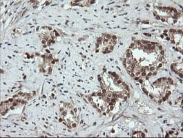 OTUB1 / OTU1 Antibody (clone OTI5F7)
