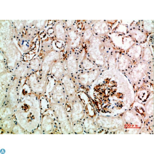 CD105 Antibody