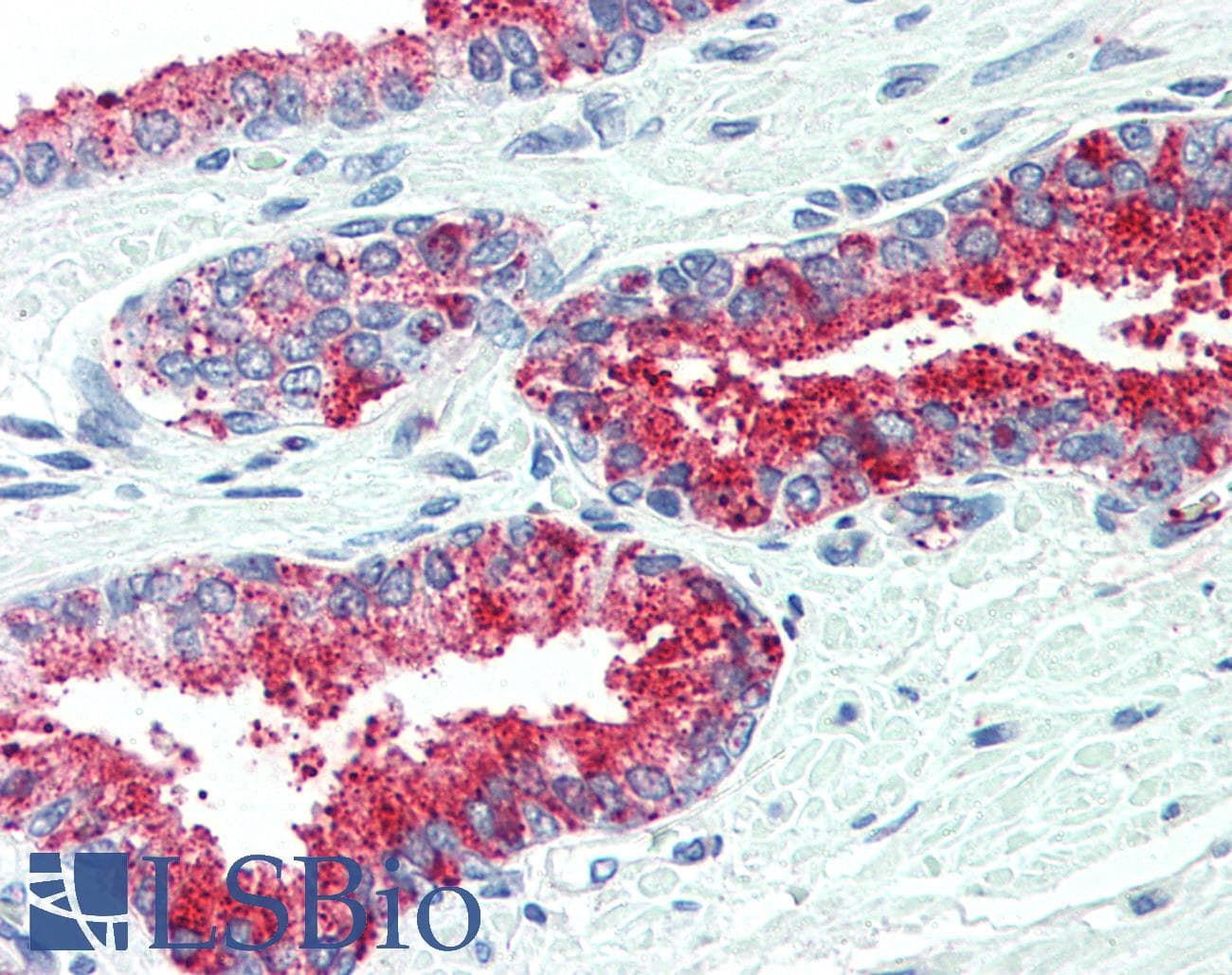 IHC-plus™ CDCP1 Antibody (Internal)