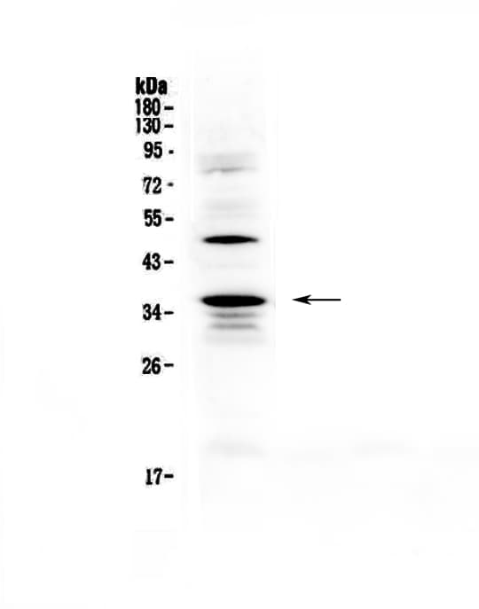 CD40L Antibody