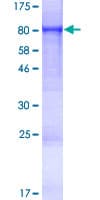 Human FEM1C Protein (Recombinant GST)
