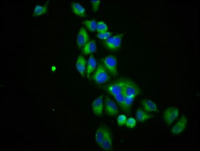 Polyclonal Rabbit anti-Human SLC12A3 / TSC Antibody (IF)
