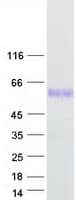 Human PV1 / PLVAP Protein (Recombinant Myc-DDK (Flag))