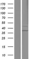 SUV420H1 Protein (Over-Expression Lysate Myc-DDK (Flag))