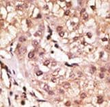 IFNL1 / IL29 Antibody (aa54-85)