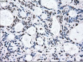 MAP2K2 / MKK2 / MEK2 Antibody (clone OTI8G6)