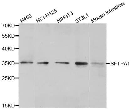 SFTPA1 / Surfactant Protein A Antibody