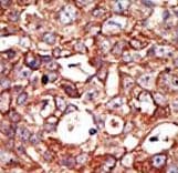 ZMPSTE24 Antibody (aa400-430)
