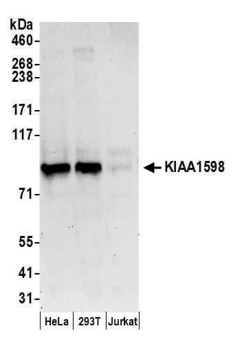 SHOOTIN1 / KIAA1598 Antibody (aa575-625)