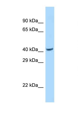 Polyclonal Rabbit anti-Human PSKH2 Antibody (aa84-133, WB)