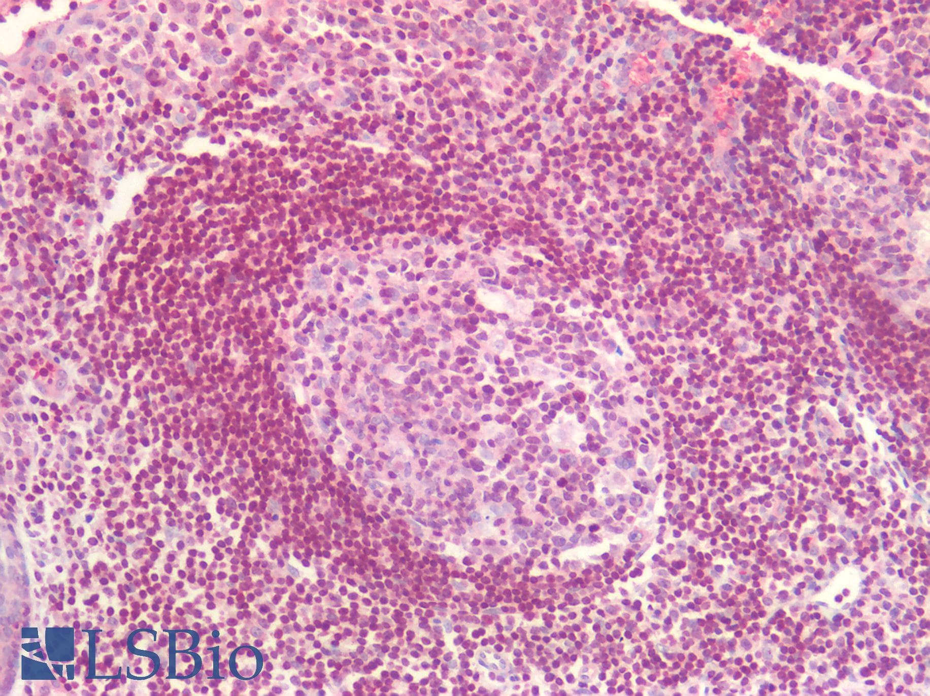 IHC-plus™ Polyclonal Rabbit anti-Human DNMT / DNMT1 Antibody (aa1603-1616, IHC)