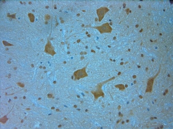 MPP4 / Discs Large Homolog 6 Antibody (aa590-635)