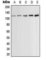 PRKD1 / PKC Mu Antibody (phospho-Ser910)